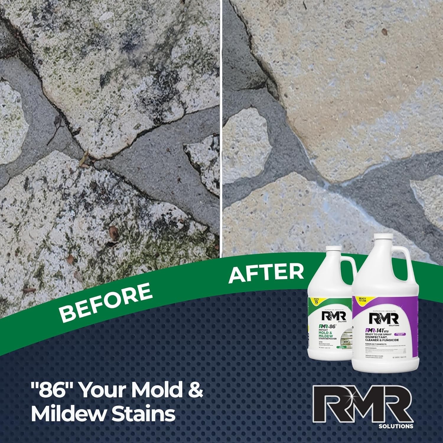 RMR Brands DIY Mold Remover Bundle – Complete Mold Killer & Stain Remover Bun…